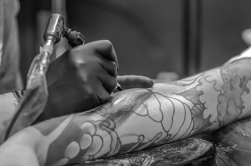 remove-tattoo