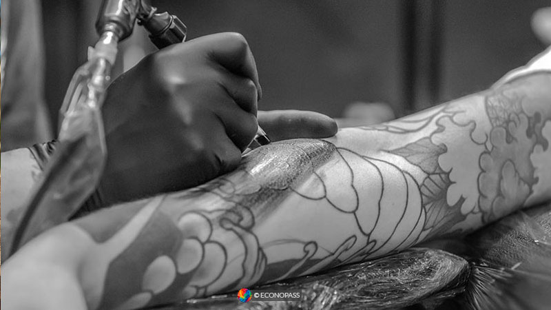 tattoo removal