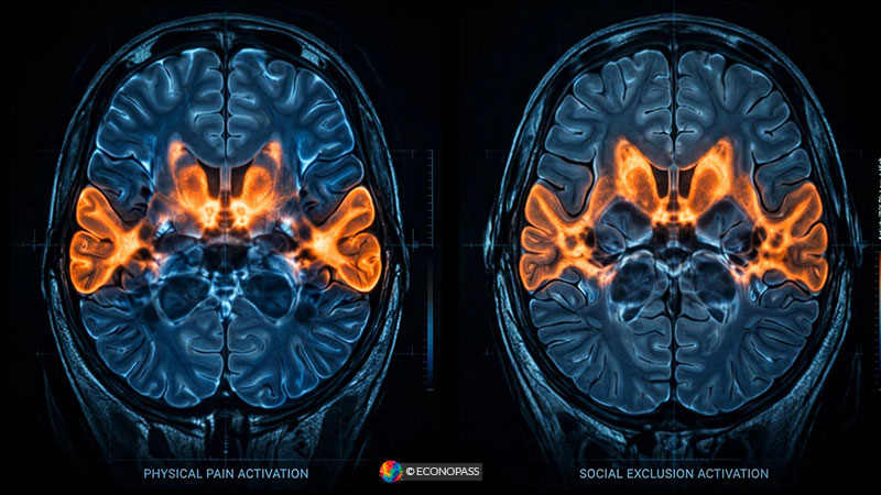 Brain Treats Rejection the Same Way It Treats a Broken Bone
