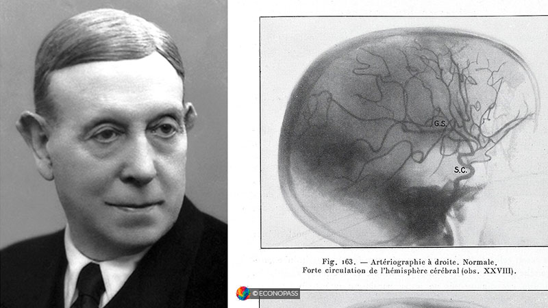 The Man Who Invented the Lobotomy